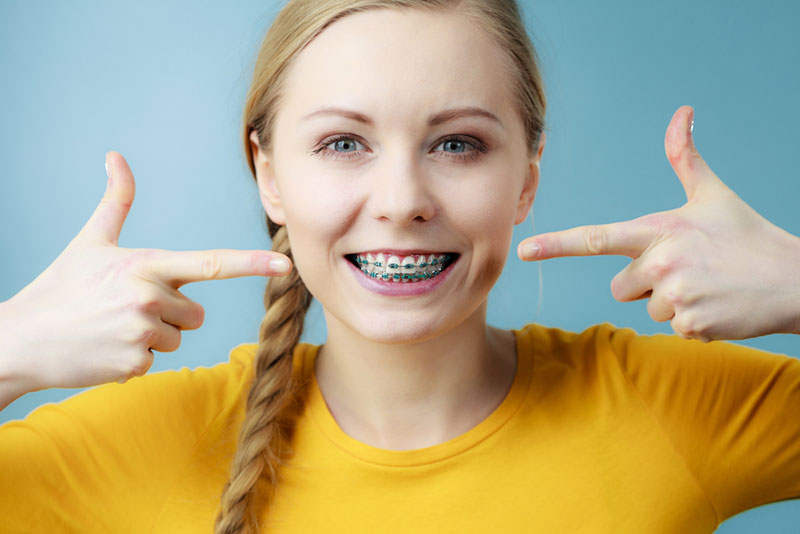 Can Braces Change One’s Facial Appearance? Here are Things to Know